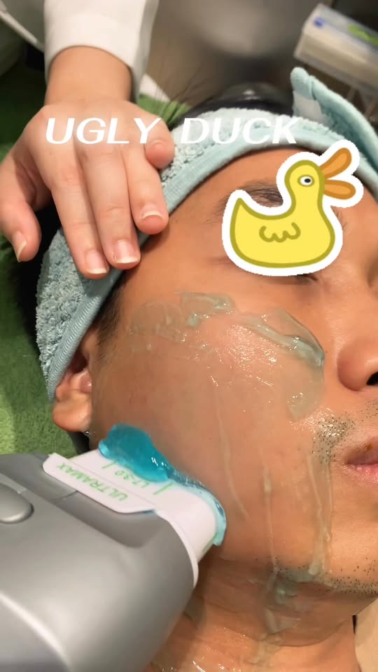 การทำเลเซอร์พิโคที่ Ugly Duck Clinic