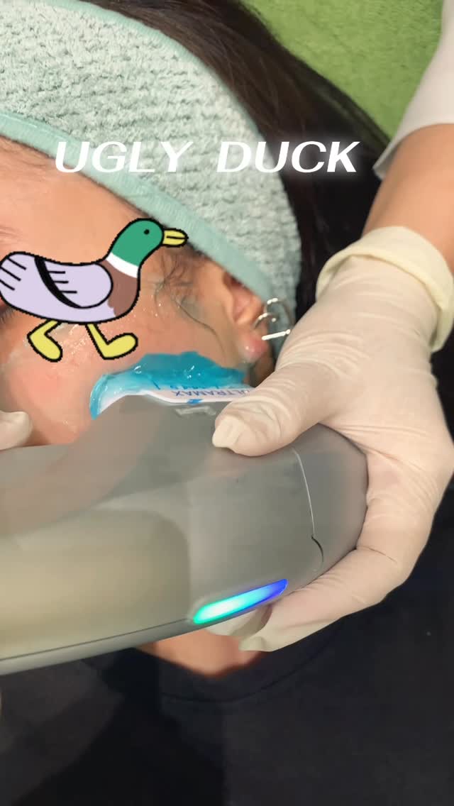 การทำ HIFU ยกกระชับหน้าที่ Ugly Duck Clinic